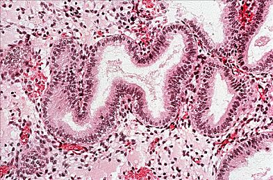 扒开腿：办公室新潮流，轻松“扒开腿”告别腰痛-1